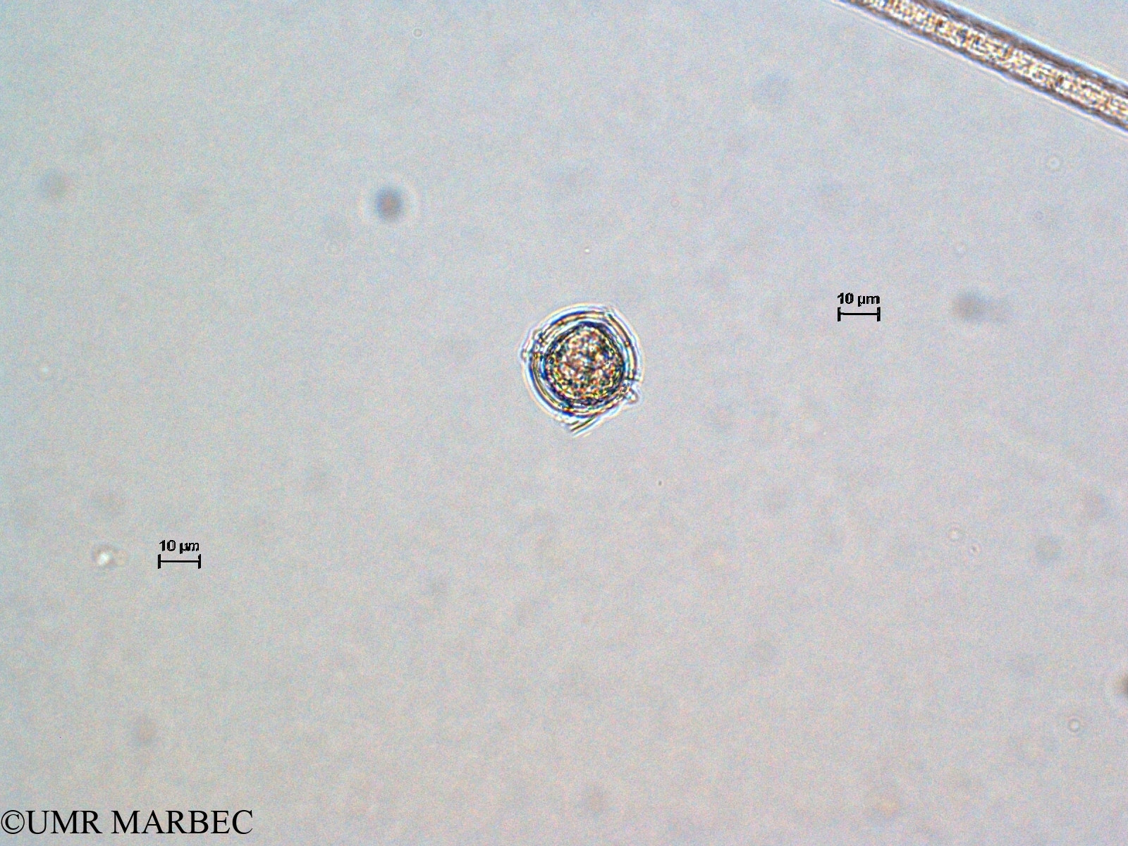 phyto/Scattered_Islands/all/COMMA April 2011/Oblea rotunda (ancien Taxon Oblea-Gotoius 2 > Obléa sp1 recomposée)(copy).jpg